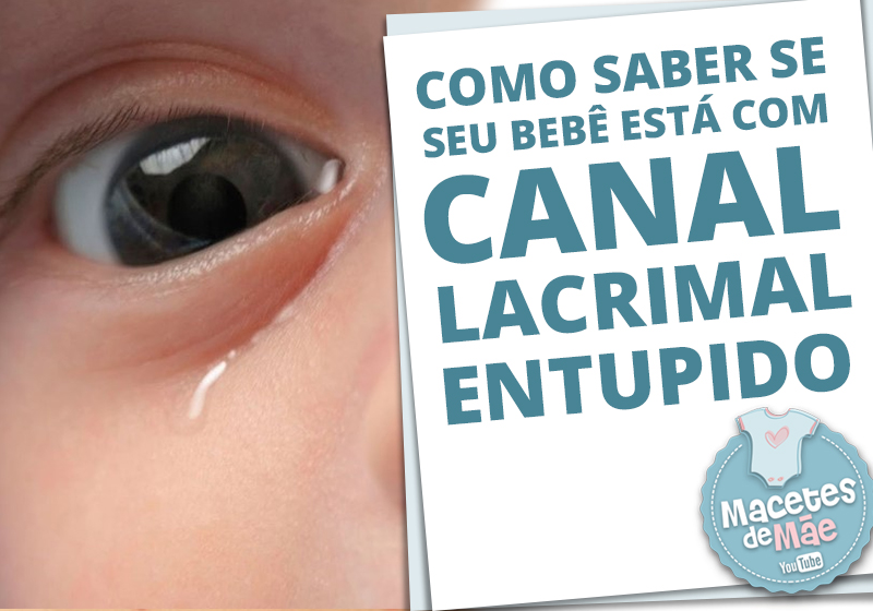 Canal lacrimal entupido